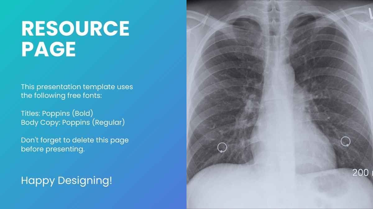 Minimal Tuberculosis Disease - slide 13
