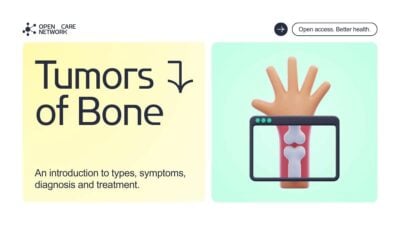 Modern 3D Tumors Of Bone Slides 1