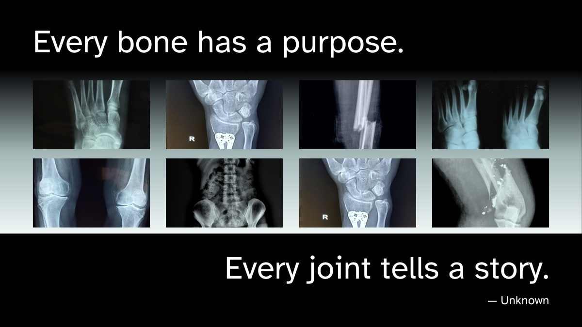 Modern Bone Background Slides - slide 7
