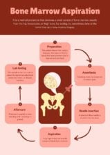 Simple Bone Marrow Aspiration Procedure Poster 1