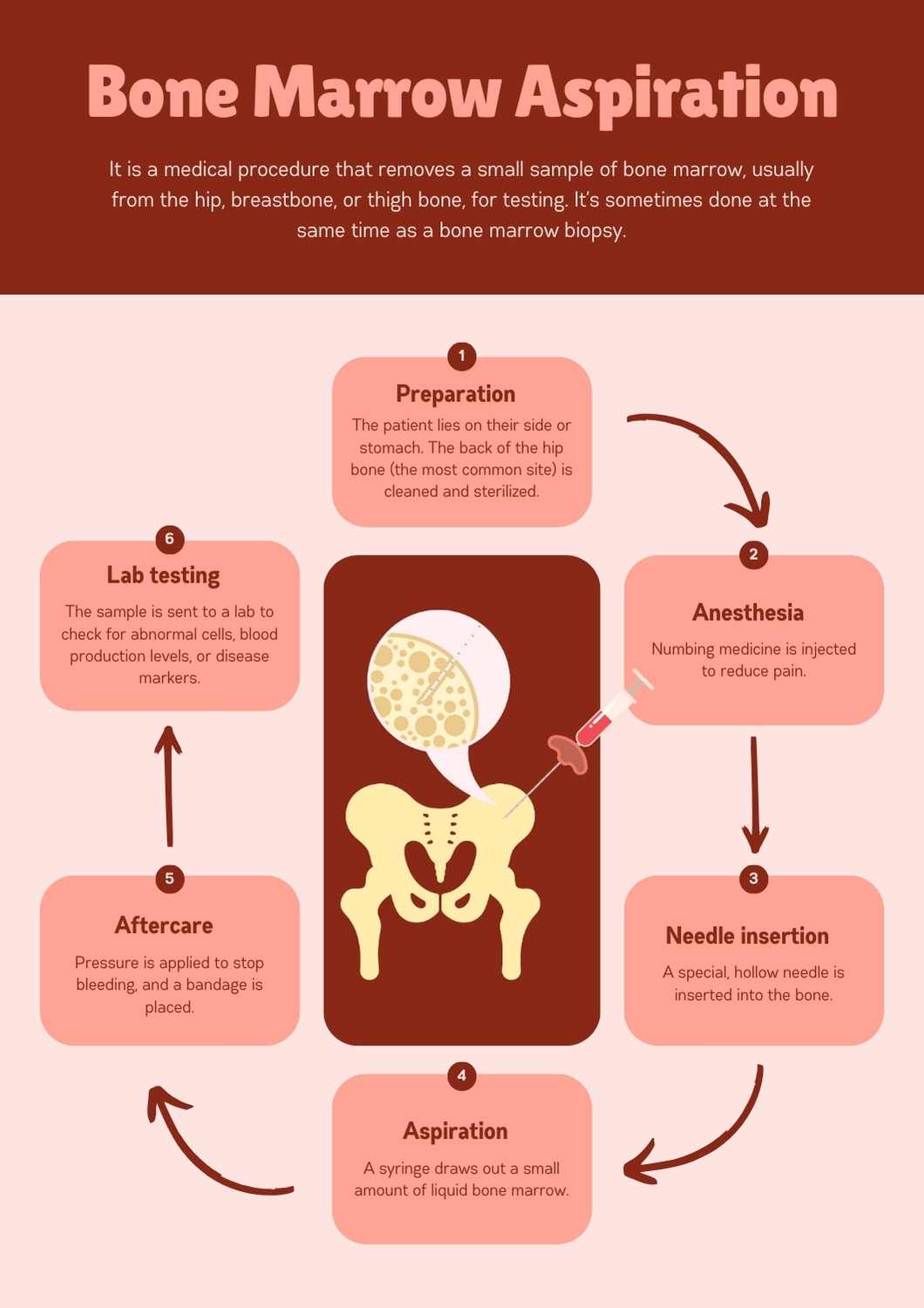 Simple Bone Marrow Aspiration Procedure Poster - slide 1